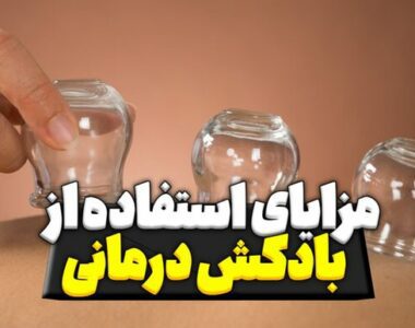 مزایای استفاده از بادکش درمانی