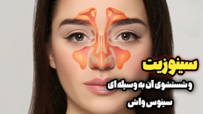 نشانه های سینوزیت شستشوی آن به وسیله ی سینوس واش نشانه های سینوزیت شستشوی آن به وسیله ی سینوس واش