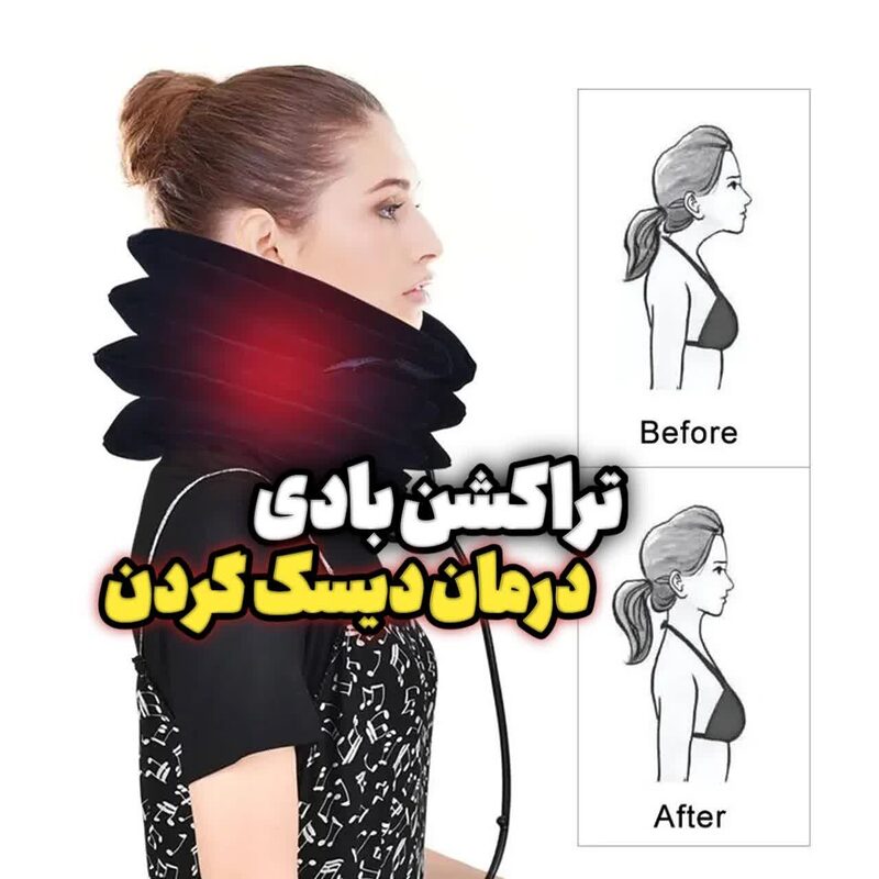 درمان گردن درد با روش ترکشن گردن درمان گردن درد با روش ترکشن گردن